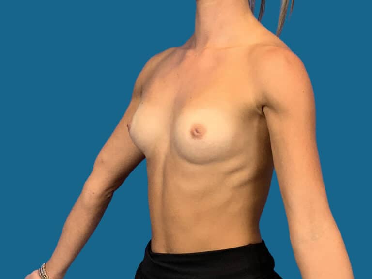 Before Image:  - left-front-oblique