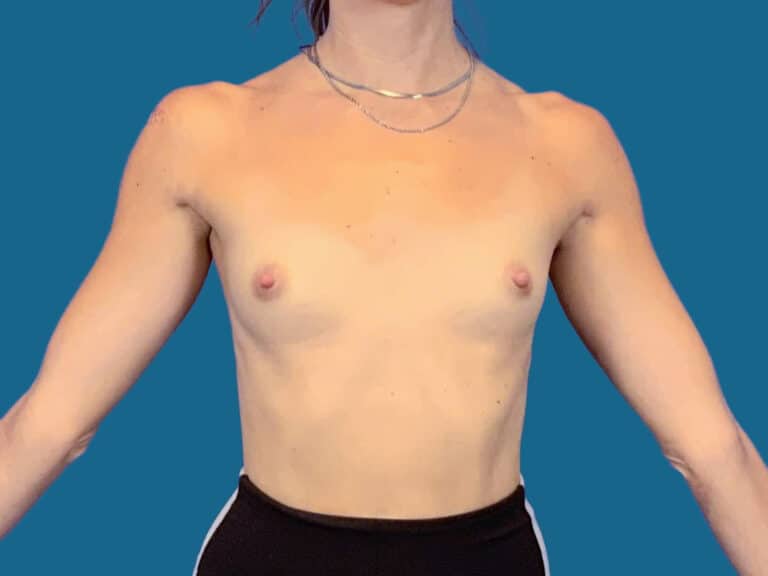 Before Image:  - front