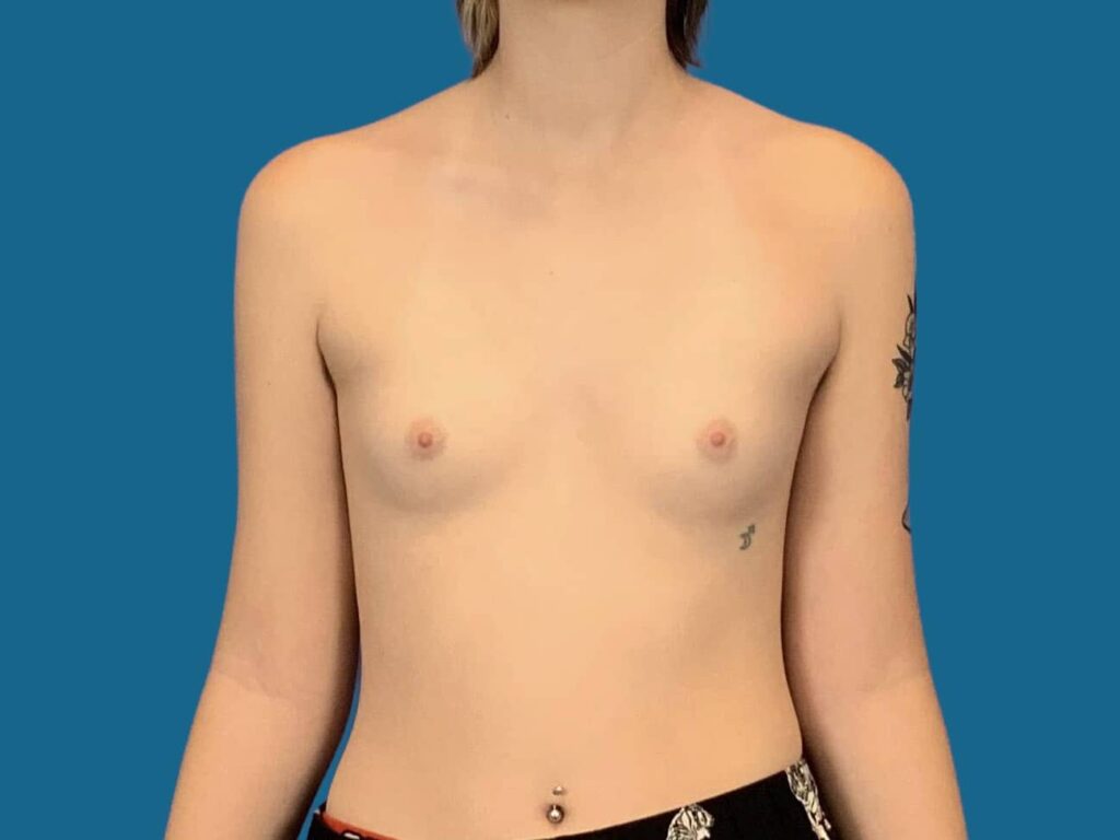 Before Image:  - front