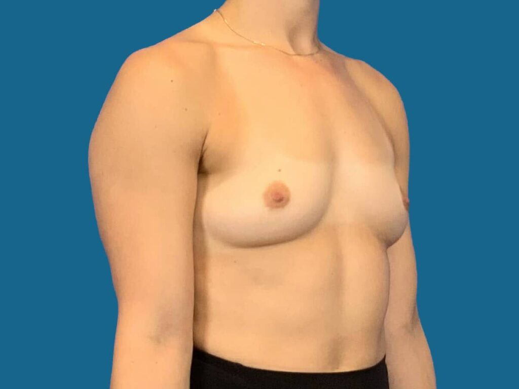 Before Image:  - front