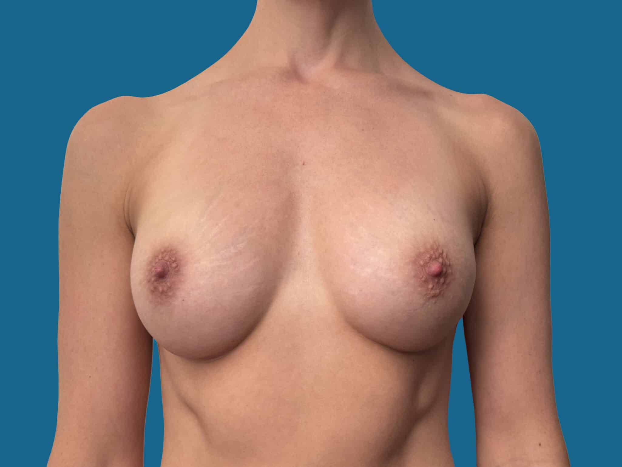 After Image:  - front