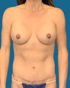 After Image: