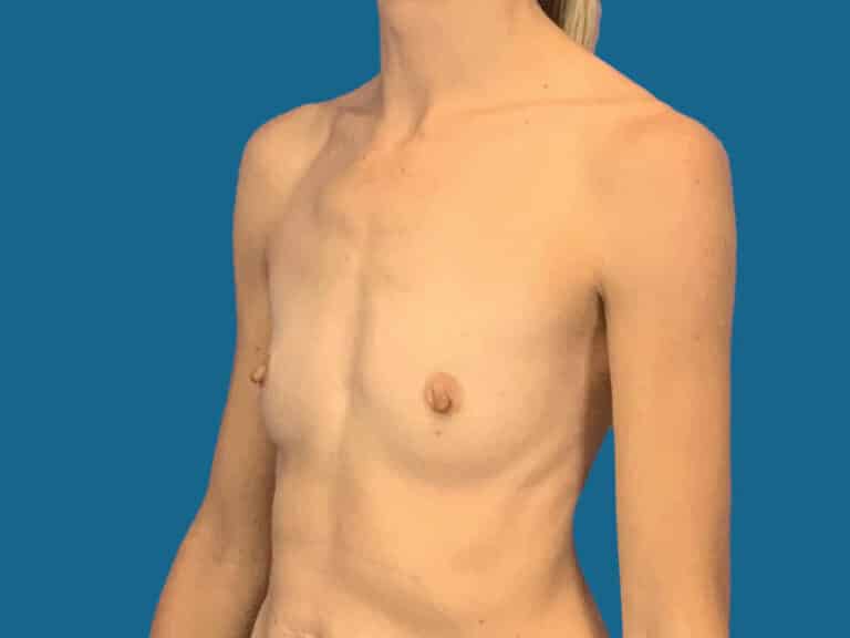 Before Image:  -