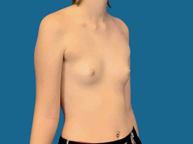 Before Image:  -