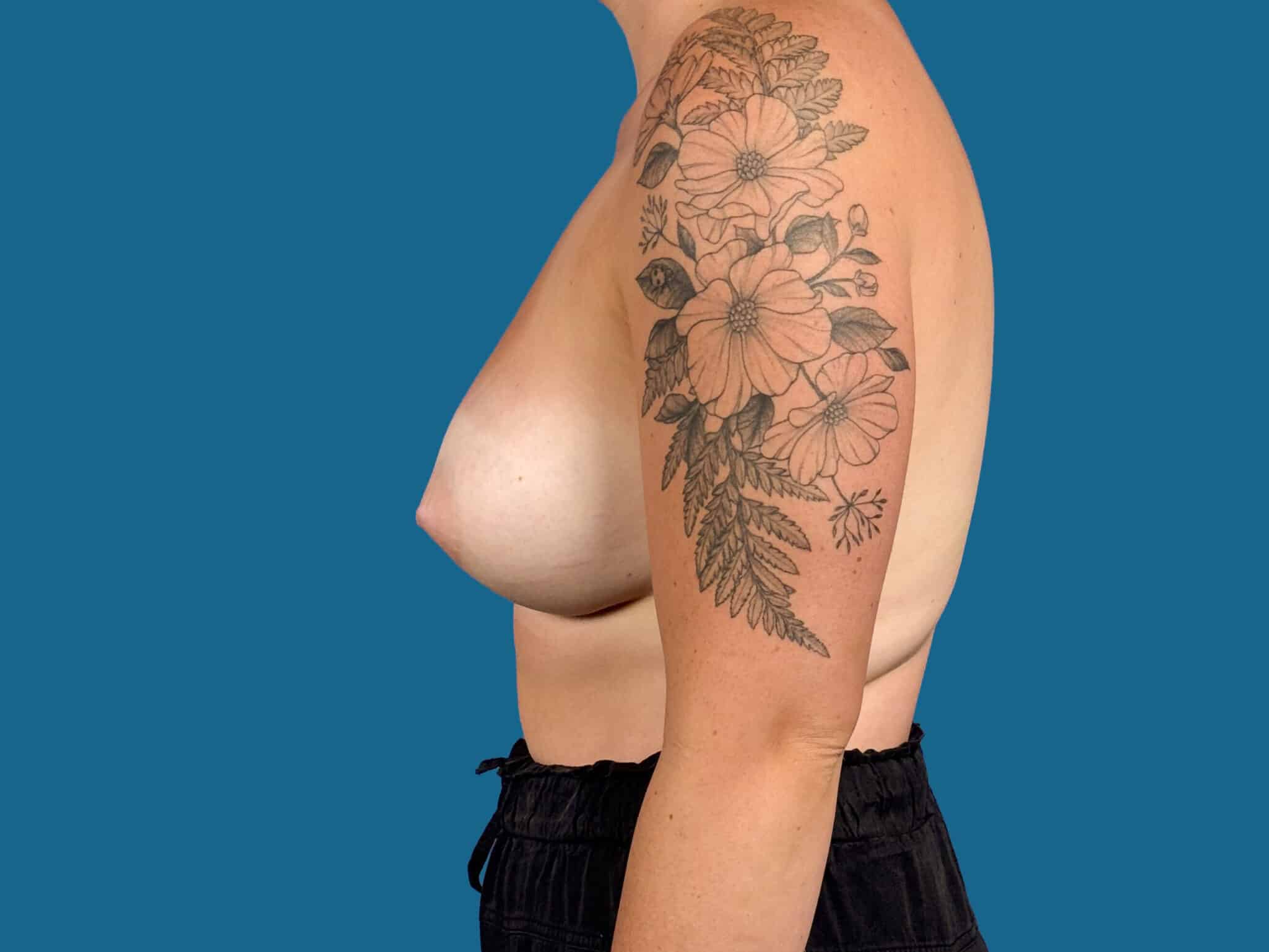After Image:  - front