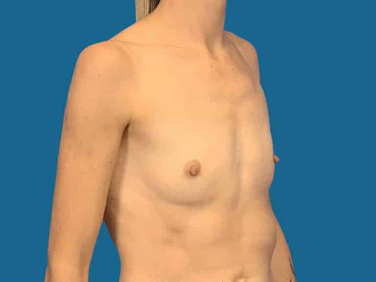 Before Image:  -