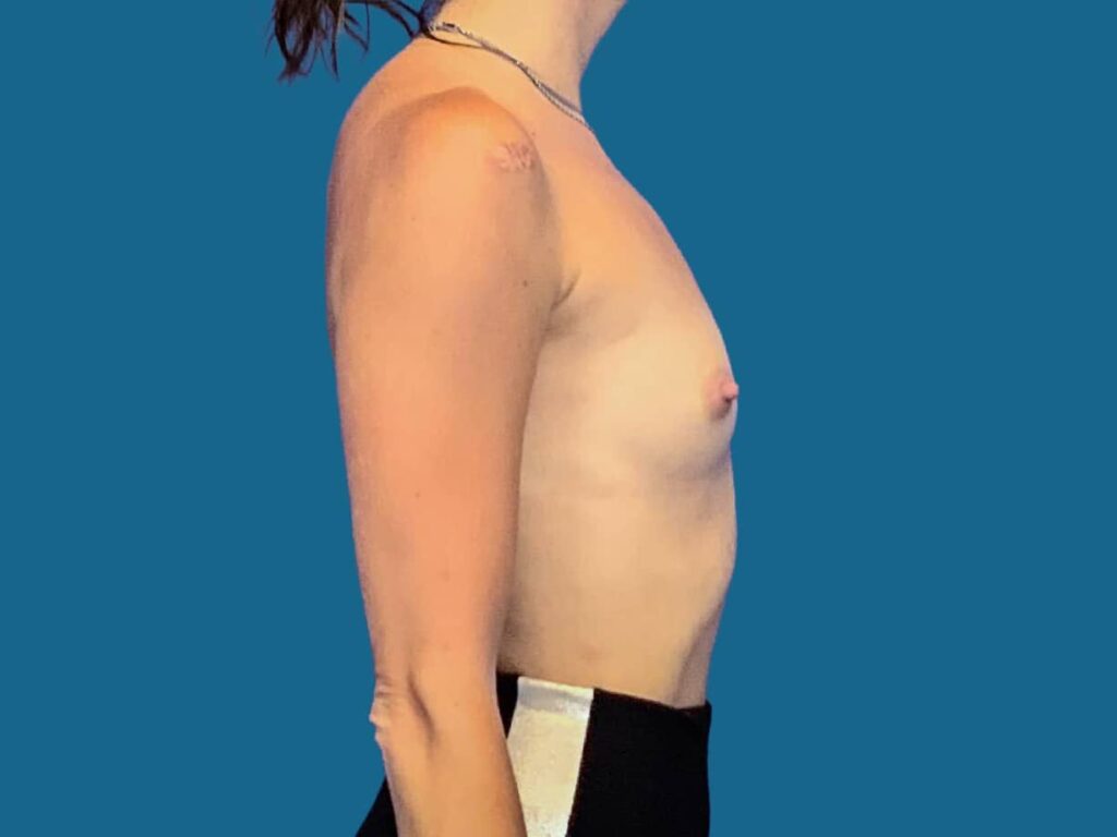 Before Image:  - front