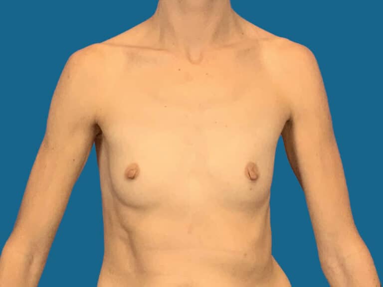 Before Image:  - front