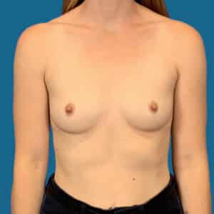 Before Image: