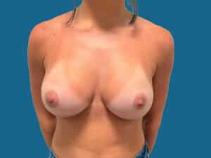 After Image:
