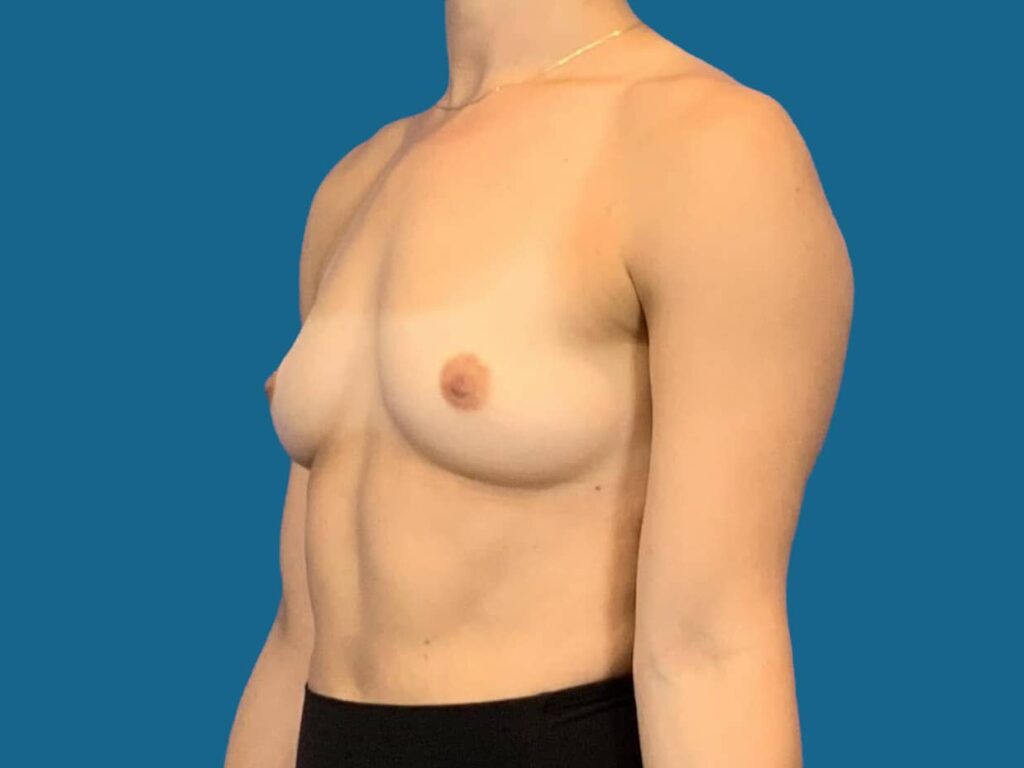 Before Image:  - front