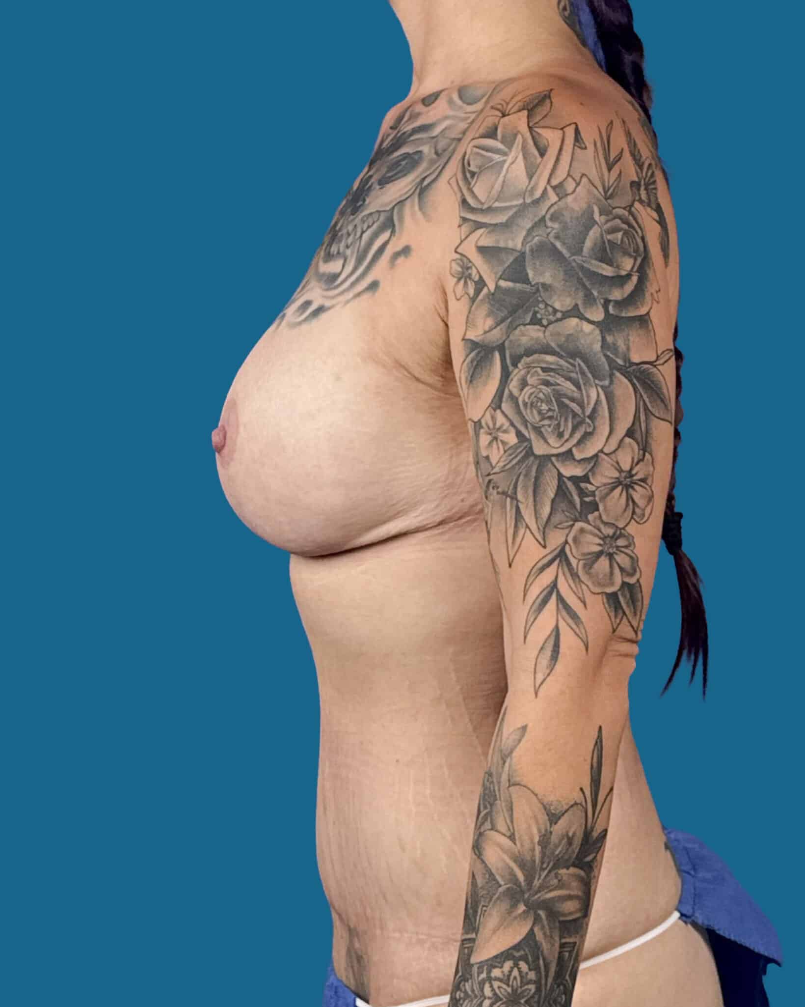 After Image:  - front