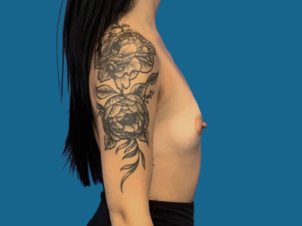 Before Image:  - right-side