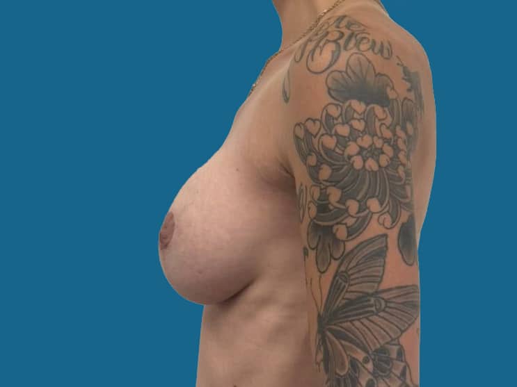 After Image:  - front