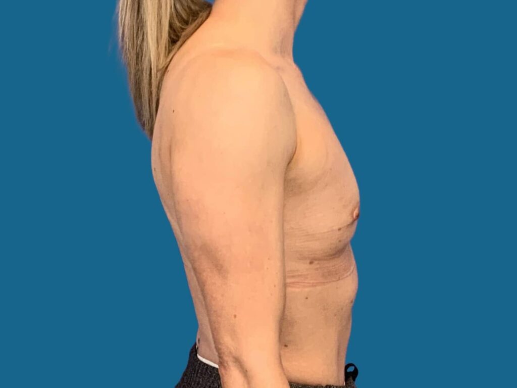 Before Image:  - front