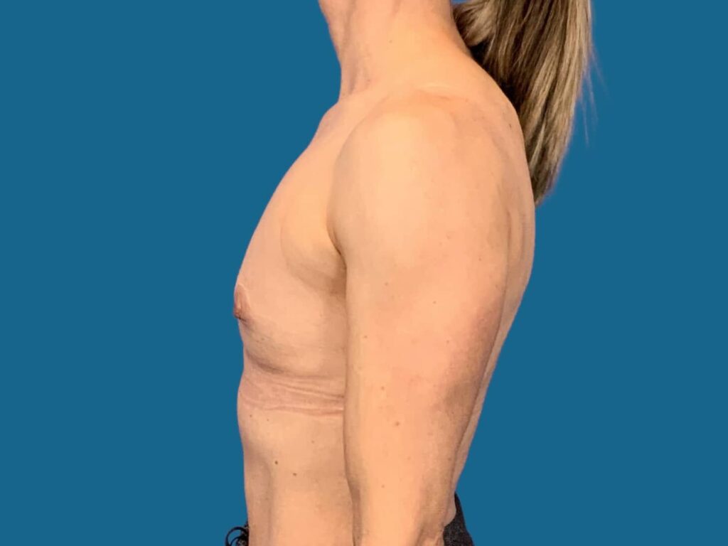 Before Image:  - front