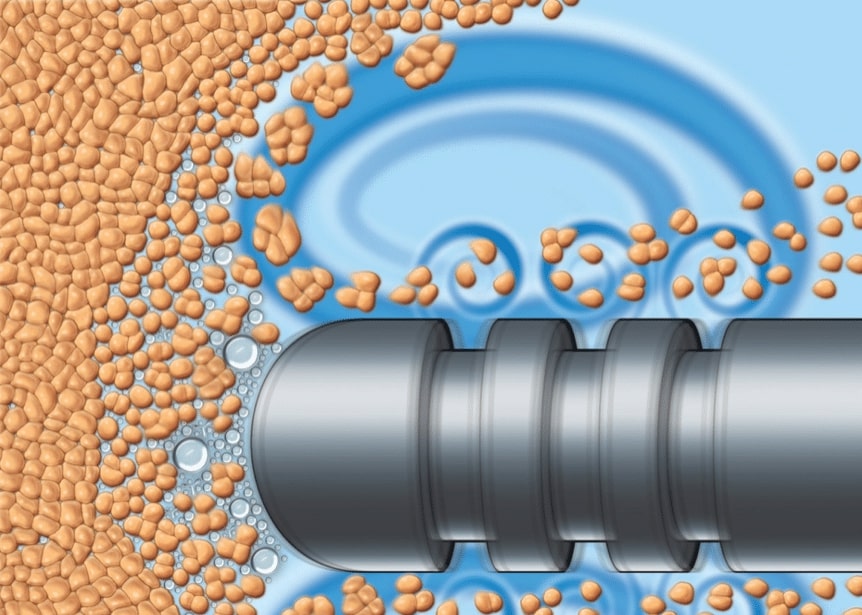 VASER Liposuction Utah