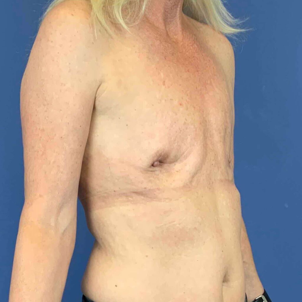 Before Image: Patient 43358 - right-front-oblique
