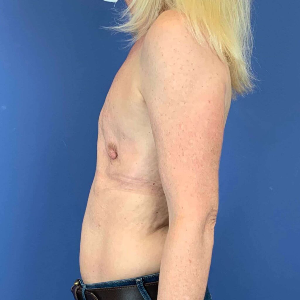 Before Image: Patient 43358 - left-side