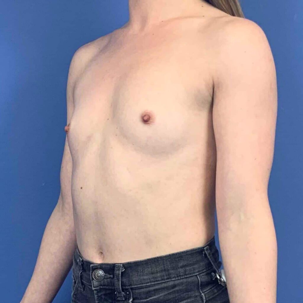 Before Image: Patient 43412 - left-front-oblique